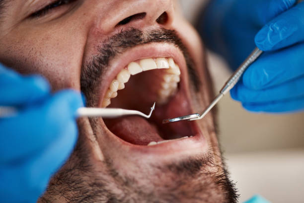 Best Dental Abscess Treatment in Coalfield, TN